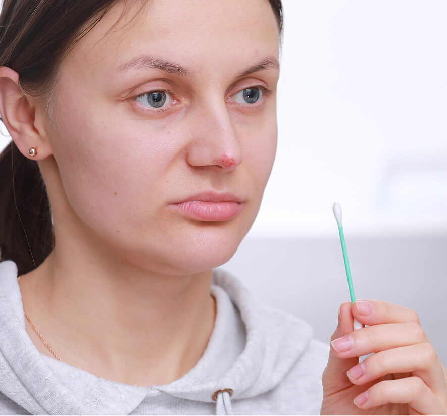 herpes-on-the-nose-pretty-young-woman-woman-hold-2024-10-18-09-31-12-utc 1 (1)